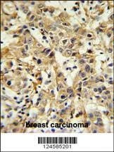 Anti-CA6 (C-term) Antibody