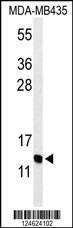 Anti-GNRH2 (Center) Antibody