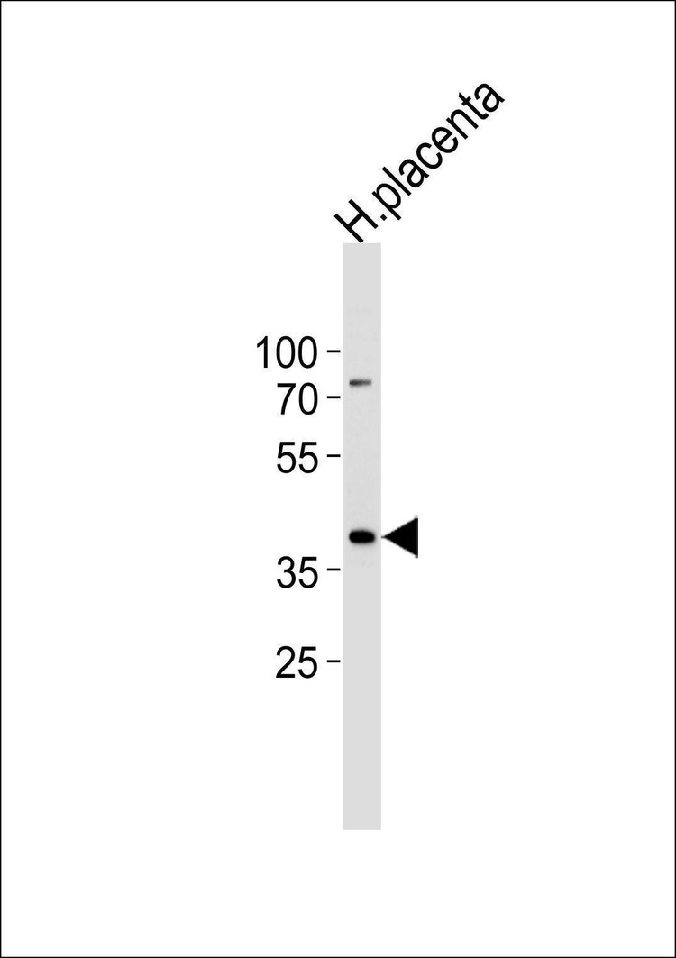 Anti-IDH3G (C-term) Antibody