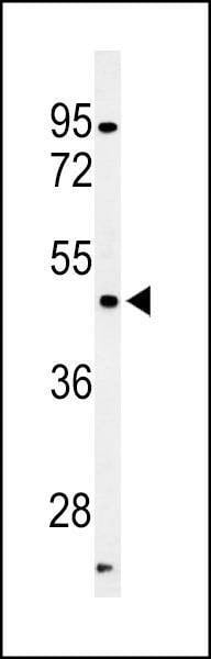 Anti-hPFTK1-M1 Antibody