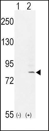 Anti-FGFR1-Y307 Antibody