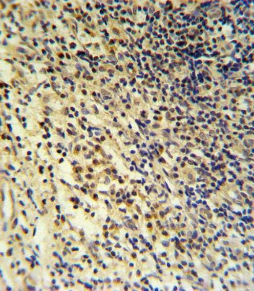 Anti-PLA2G7 (Center) Antibody