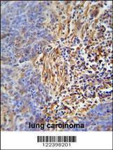 Anti-HLA-DRB5 (Center) Antibody