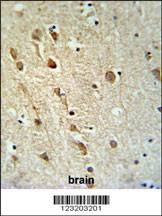Anti-ZRANB1 (C-term) Antibody