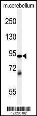 Anti-ZRANB1 (C-term) Antibody