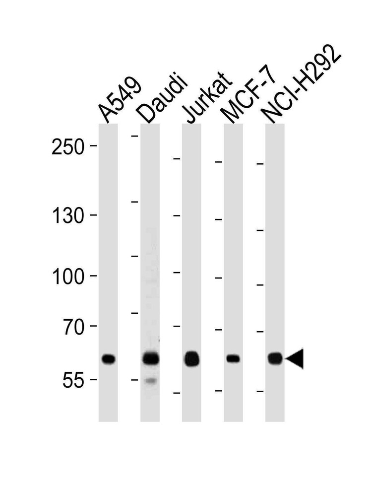 Anti-FOXP1 (C-term) Antibody
