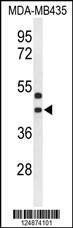 Anti-GPR17 (Center) Antibody