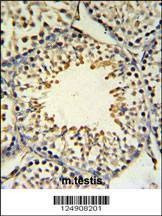Anti-ACBG2 (Center) Antibody