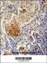 Anti-TYROBP (C-term) Antibody