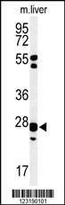 Anti-GSTK1 (Center) Antibody