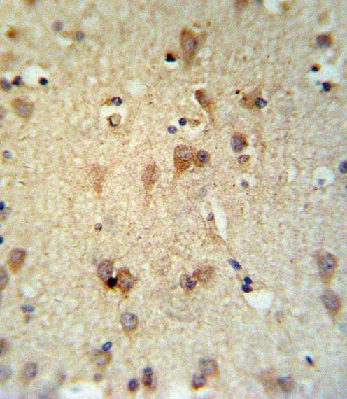Anti-LCAT (Center) Antibody