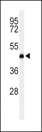 Anti-LCAT (Center) Antibody
