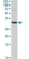 Anti-MAD2L1BP Antibody