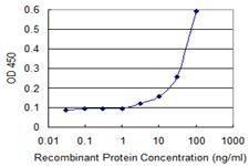 Anti-MAD2L1BP Antibody