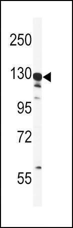 Anti-GTSE1 (C-term) Antibody