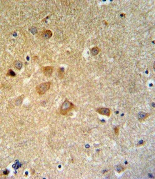 Anti-GTSE1 (C-term) Antibody