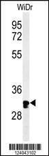 Anti-HCCS (Center) Antibody