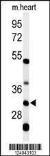 Anti-HCCS (Center) Antibody