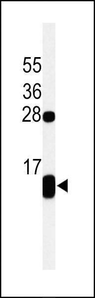 Anti-PLB-T17 Antibody