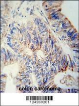 Anti-B3GNT6 (Center) Antibody