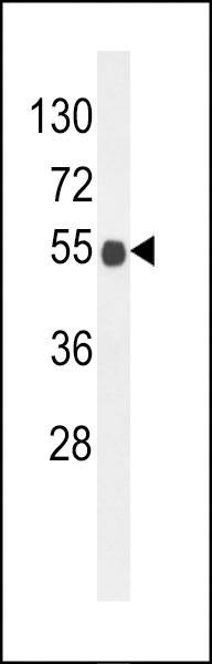 Anti-B3GNT6 (Center) Antibody