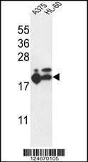 Anti-RPL17 (C-term) Antibody