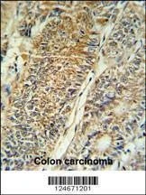 Anti-PYCR1 (C-term) Antibody