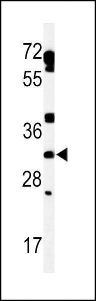 Anti-TBCD7 (Center) Antibody
