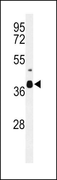 Anti-CC058 (Center) Antibody
