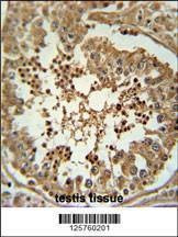 Anti-CC058 (Center) Antibody
