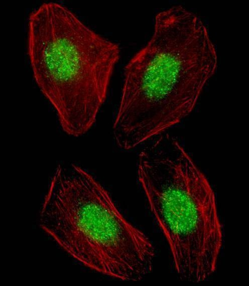 Anti-NR1H3 (Center) Antibody