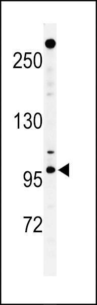 Anti-NUP210 (N-term) Antibody
