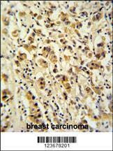 Anti-DDX49 (C-term) Antibody