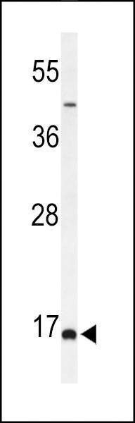 Anti-FAM44B (C-term) Antibody