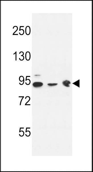 Anti-DNAJC6 (Center) Antibody