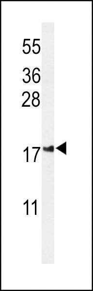 Anti-IMP2L (Center) Antibody