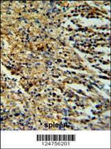 Anti-PHTNS (N-term) Antibody