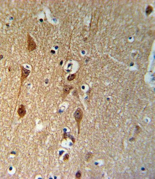 Anti-SMAD3-S208 Antibody