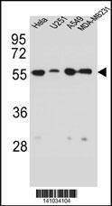 Anti-Vimentin Antibody