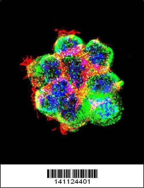 Anti-CTNNB1 (C-term) Antibody