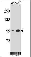 Anti-CTNNB1 (N-term) Antibody