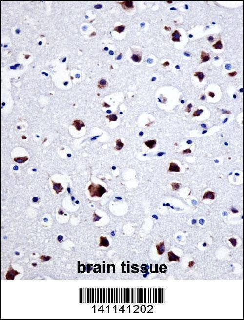 Anti-SRC (N-term) Antibody