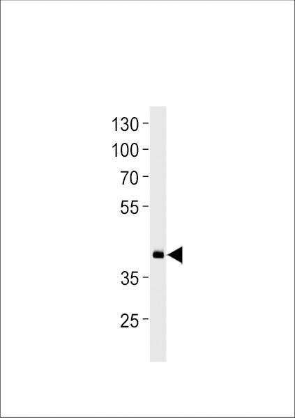 Anti-Zebrafish hoxd11a (Center) Antibody