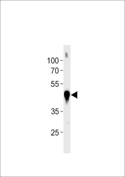 Anti-Zebrafish actba (Center) Antibody