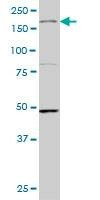 Anti-MAP3K4 Antibody