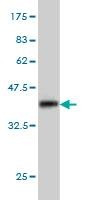 Anti-MAP3K4 Antibody