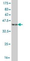 Anti-MAP3K5 Antibody
