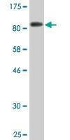 Anti-MAP3K7IP1 Antibody