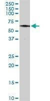 Anti-MAP3K7IP1 Antibody