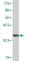 Anti-MAPK8 Antibody